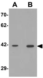 Anti-SLC35D2 antibody used in Western Blot (WB). GTX32037