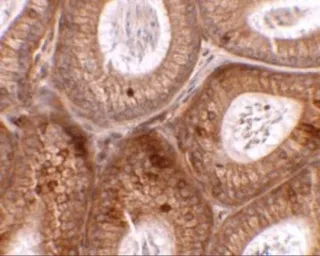Anti-SPINK2 antibody used in IHC (Paraffin sections) (IHC-P). GTX32051