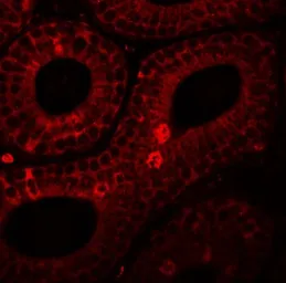 Anti-SPINK2 antibody used in IHC (Paraffin sections) (IHC-P). GTX32051