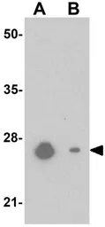 Anti-Nkx2.6 antibody used in Western Blot (WB). GTX32059