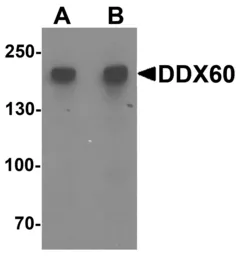 Anti-DDX60 antibody used in Western Blot (WB). GTX32082
