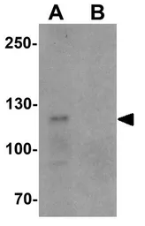 Anti-TCIRG1 antibody used in Western Blot (WB). GTX32087