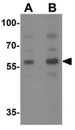 Anti-PLAGL2 antibody used in Western Blot (WB). GTX32095