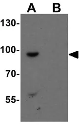 Anti-SHROOM1 antibody used in Western Blot (WB). GTX32098