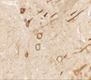 Anti-PRRT2 antibody used in IHC (Paraffin sections) (IHC-P). GTX32116