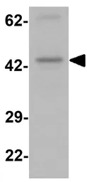 Anti-PRRT2 antibody used in Western Blot (WB). GTX32116