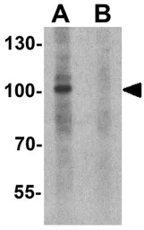 Anti-NDST2 antibody used in Western Blot (WB). GTX32135