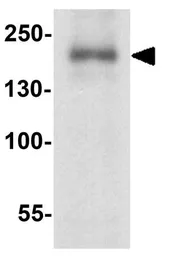 Anti-TRIP12 antibody used in Western Blot (WB). GTX32138