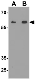 Anti-KIRREL3 antibody used in Western Blot (WB). GTX32140