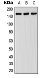 Anti-FANCA (phospho Ser1149) antibody used in Western Blot (WB). GTX32179