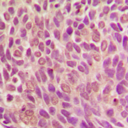 Anti-Smad1 (phospho Ser187) antibody used in IHC (Paraffin sections) (IHC-P). GTX32213