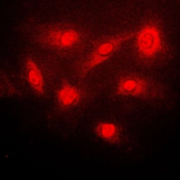 Anti-IKB beta (phospho Ser23) antibody used in Immunocytochemistry/ Immunofluorescence (ICC/IF). GTX32225