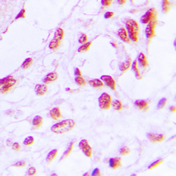 Anti-Rb (phospho Ser780) antibody used in IHC (Paraffin sections) (IHC-P). GTX32254