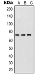 Anti-NFkB p65 (phospho Ser468) antibody used in Western Blot (WB). GTX32256