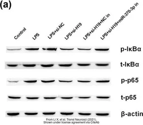 Anti-NFkB p65 (phospho Ser468) antibody used in Western Blot (WB). GTX32256