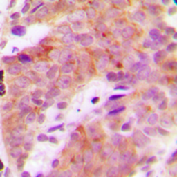 Anti-p70 S6K (phospho Thr421) antibody used in IHC (Paraffin sections) (IHC-P). GTX32259