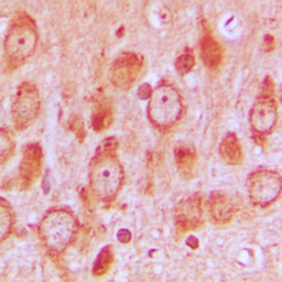 Anti-Src (phospho Ser75) antibody used in IHC (Paraffin sections) (IHC-P). GTX32263