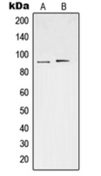 Anti-STAT3 (phospho Ser727) antibody used in Western Blot (WB). GTX32267