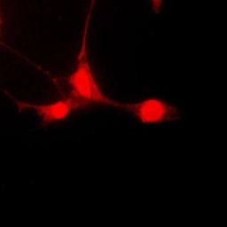 Anti-STAT5A (phospho Ser780) antibody used in Immunocytochemistry/ Immunofluorescence (ICC/IF). GTX32268