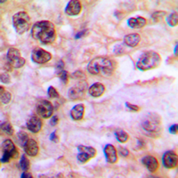Anti-IKK gamma (phospho Ser85) antibody used in IHC (Paraffin sections) (IHC-P). GTX32283