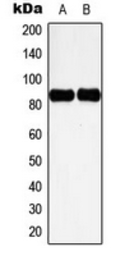 Anti-Cortactin (phospho Tyr466) antibody used in Western Blot (WB). GTX32326