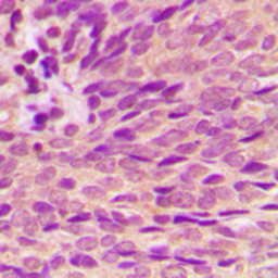 Anti-Estrogen Receptor alpha (phospho Ser118) antibody used in IHC (Paraffin sections) (IHC-P). GTX32327