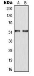 Anti-HNF4 alpha (phospho Ser313) antibody used in Western Blot (WB). GTX32329