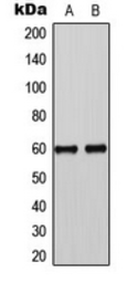 Anti-SMAD3 (phospho Ser425) antibody used in Western Blot (WB). GTX32335