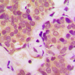 Anti-STAT6 (phospho Tyr641) antibody used in IHC (Paraffin sections) (IHC-P). GTX32357