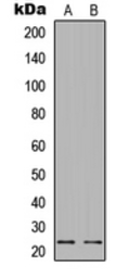 Anti-Bad (phospho Ser112) antibody used in Western Blot (WB). GTX32370