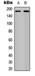Anti-Her4 / ErbB4 (phospho Tyr1284) antibody used in Western Blot (WB). GTX32389
