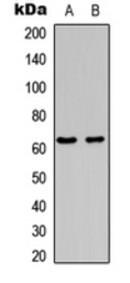 Anti-c-Fos (phospho Ser362) antibody used in Western Blot (WB). GTX32391