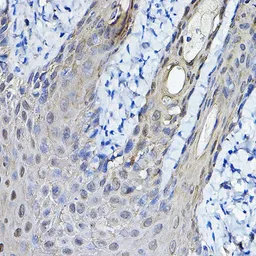 Anti-14-3-3 sigma antibody used in IHC (Paraffin sections) (IHC-P). GTX32418