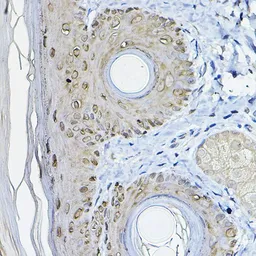 Anti-14-3-3 sigma antibody used in IHC (Paraffin sections) (IHC-P). GTX32418
