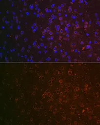 Anti-ABAT antibody used in IHC (Paraffin sections) (IHC-P). GTX32420
