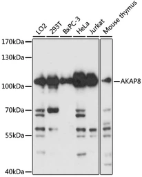 Anti-AKAP8 antibody used in Western Blot (WB). GTX32429