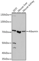 Anti-Albumin antibody used in Western Blot (WB). GTX32430