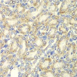 Anti-AMPK beta 2 antibody used in IHC (Paraffin sections) (IHC-P). GTX32439