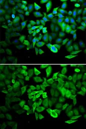 Anti-Annexin A1 antibody used in Immunocytochemistry/ Immunofluorescence (ICC/IF). GTX32444