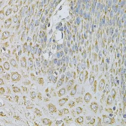 Anti-AP2B1 antibody used in IHC (Paraffin sections) (IHC-P). GTX32450