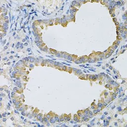 Anti-AP2B1 antibody used in IHC (Paraffin sections) (IHC-P). GTX32450