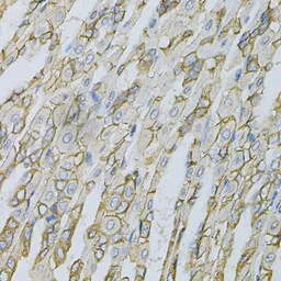 Anti-AP2B1 antibody used in IHC (Paraffin sections) (IHC-P). GTX32450