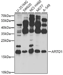 Anti-APITD1 antibody used in Western Blot (WB). GTX32452