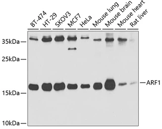Anti-ARF1 antibody used in Western Blot (WB). GTX32454