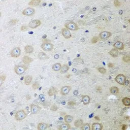 Anti-ATAD3A antibody used in IHC (Paraffin sections) (IHC-P). GTX32458