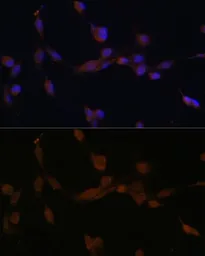 Anti-ATG7 antibody used in Immunocytochemistry/ Immunofluorescence (ICC/IF). GTX32459