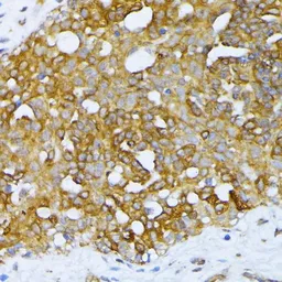 Anti-ATG7 antibody used in IHC (Paraffin sections) (IHC-P). GTX32459