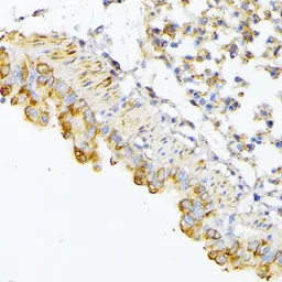 Anti-ATG7 antibody used in IHC (Paraffin sections) (IHC-P). GTX32459