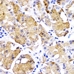 Anti-BMPR1B antibody used in IHC (Paraffin sections) (IHC-P). GTX32474