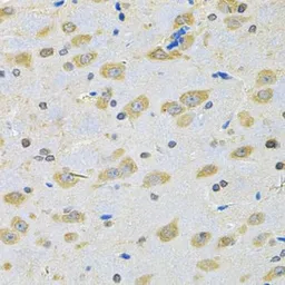 Anti-BNIP1 antibody used in IHC (Paraffin sections) (IHC-P). GTX32475
